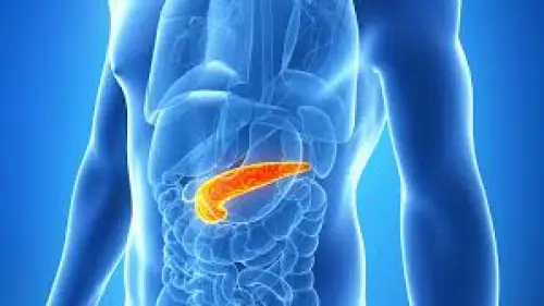 La Pancreatite